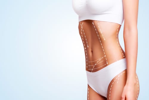 Tumescent Liposuction Henderson NV