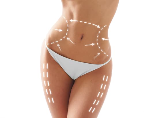 Liposuction Henderson NV