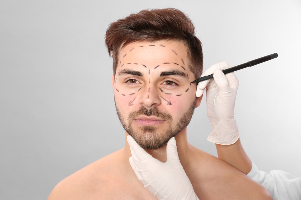Doctor,Drawing,Marks,On,Man's,Face,For,Cosmetic,Surgery,Operation