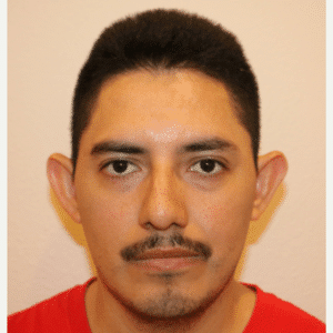 Before Image: Ear Surgery