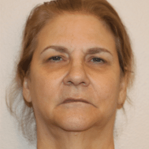 Before Image: Facelift