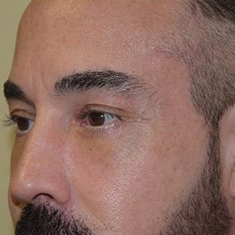 After Image: TCA Peel - left-front-oblique