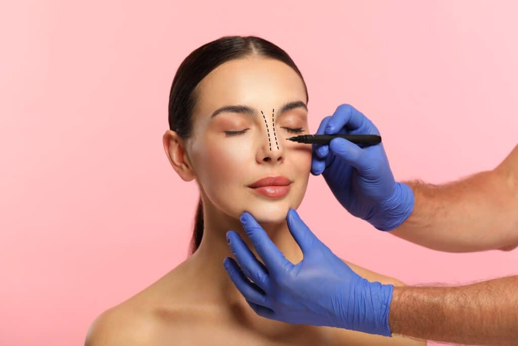 Woman having her nose drawn on in preparation for her rhinoplasty to improve function and beauty