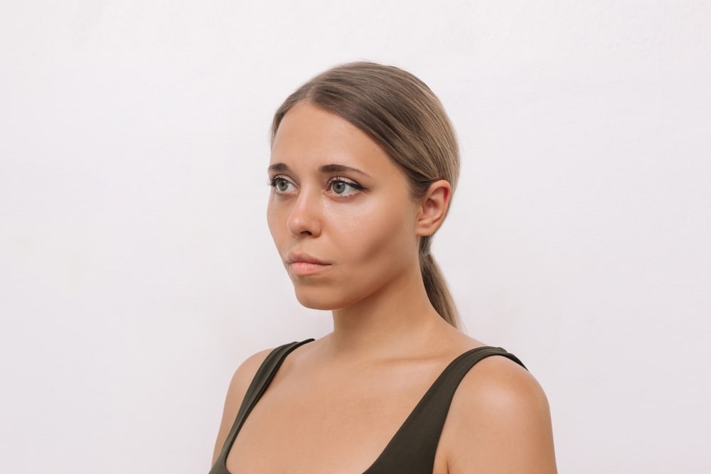 Woman with sunken cheekbones, in need of a facial fat transfer.