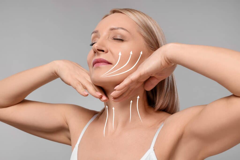 Middle-aged woman looking up and touching her jawline with arrows to show her neck lift's influence