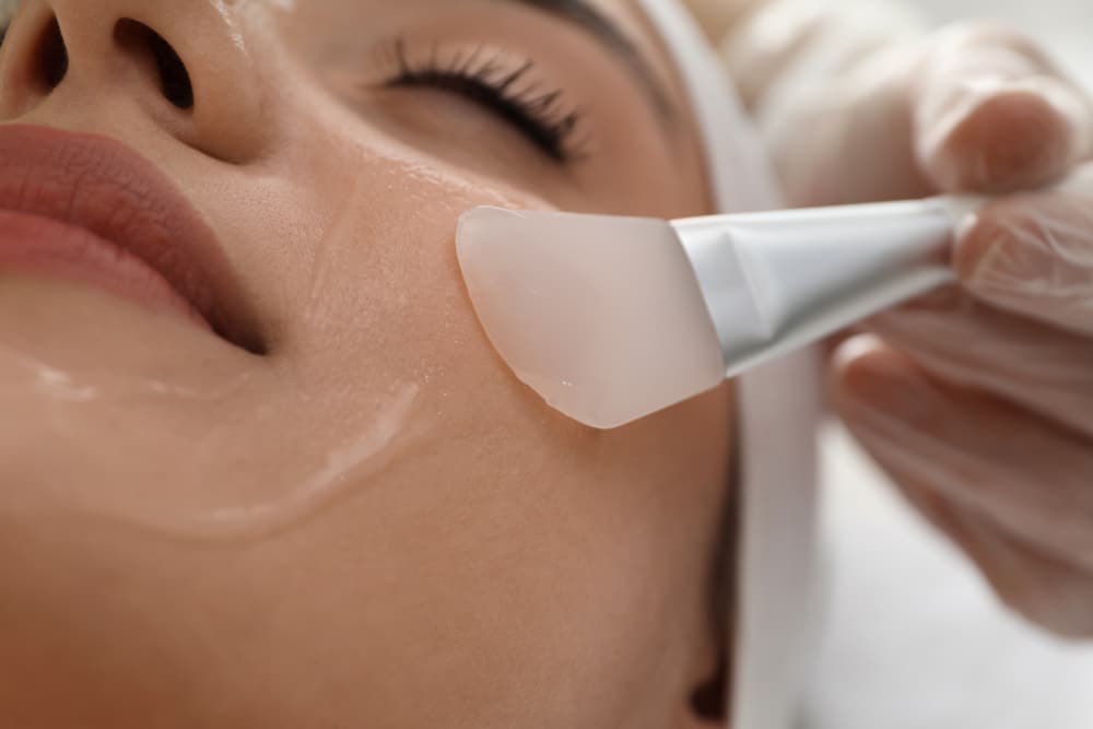 Close up of a patient having a chemical peel applied to their face in a spa-like setting.